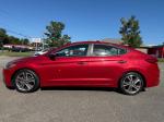 2017 Hyundai Elantra Pic 2335_V2025082815300600012