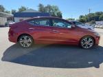2017 Hyundai Elantra Pic 2335_V2025082815300600016