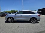 2017 Acura Mdx Pic 2825_V2025070612325700022